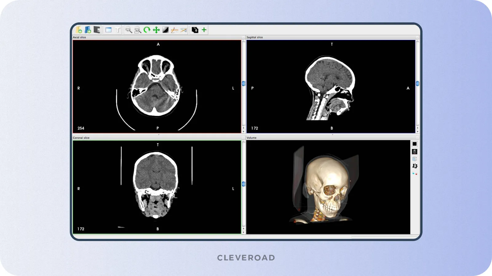 3D reconstruction feature example