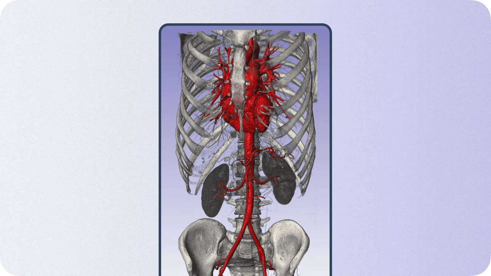 3D volume skeleton rendering example