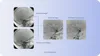Image registration feature example