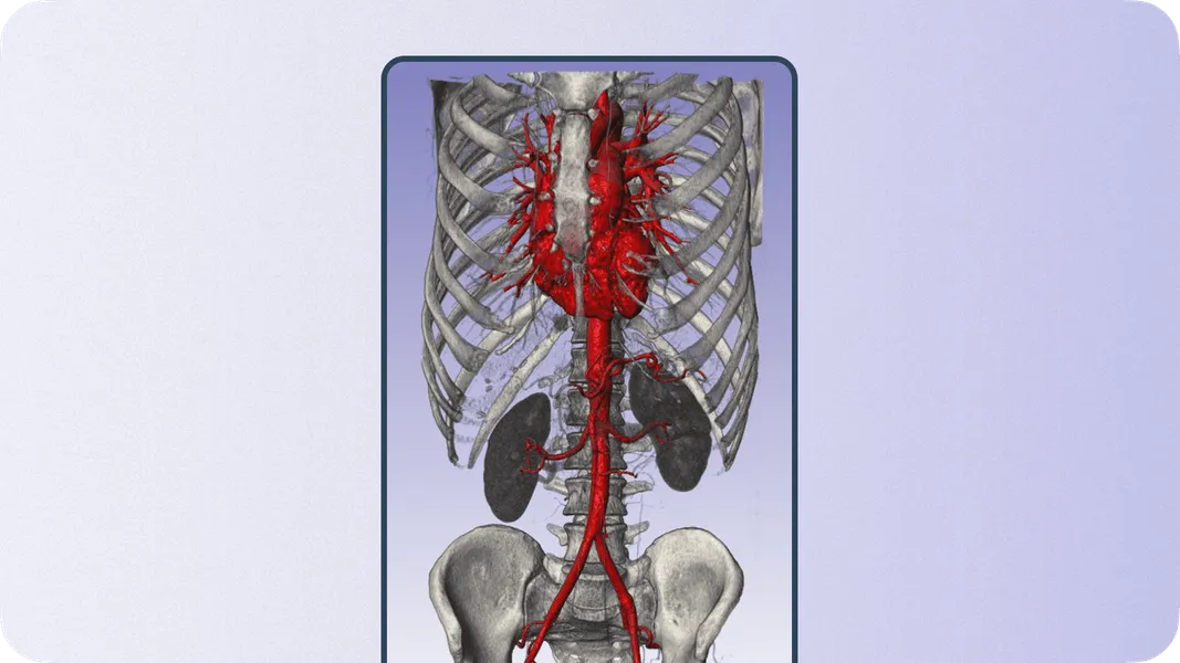 3D volume skeleton rendering example