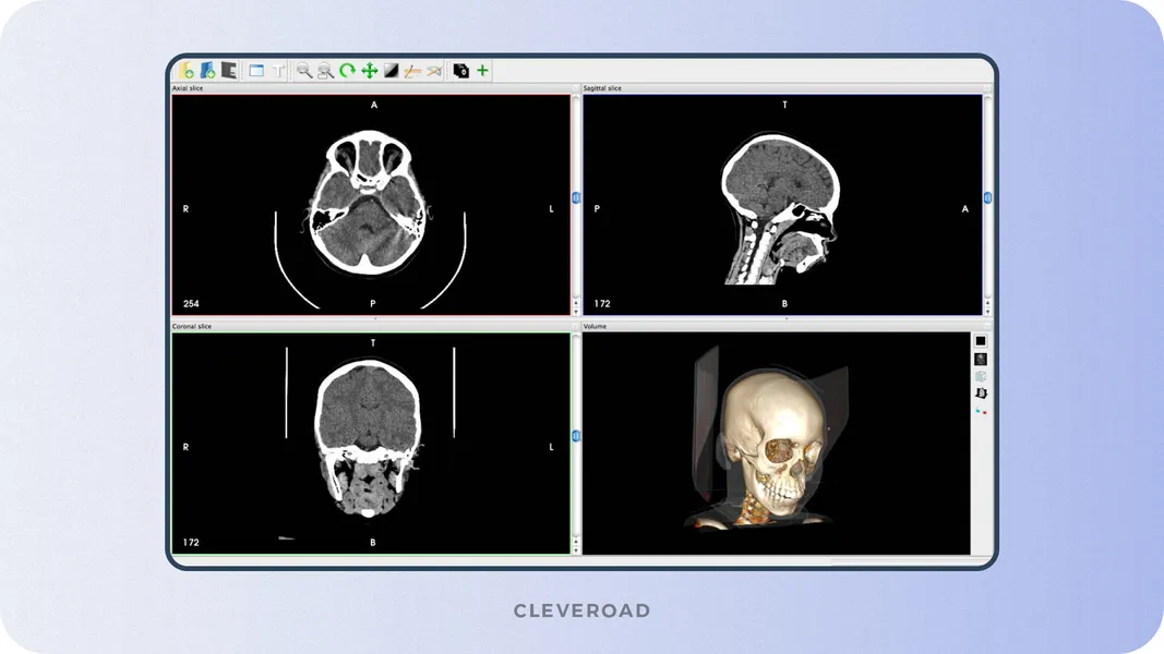 3D reconstruction feature example