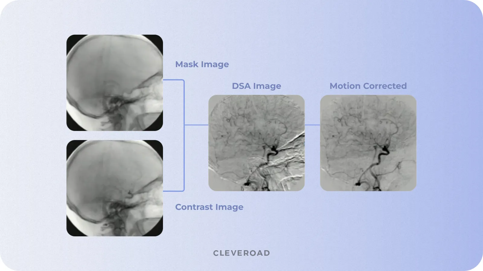 Image registration feature example