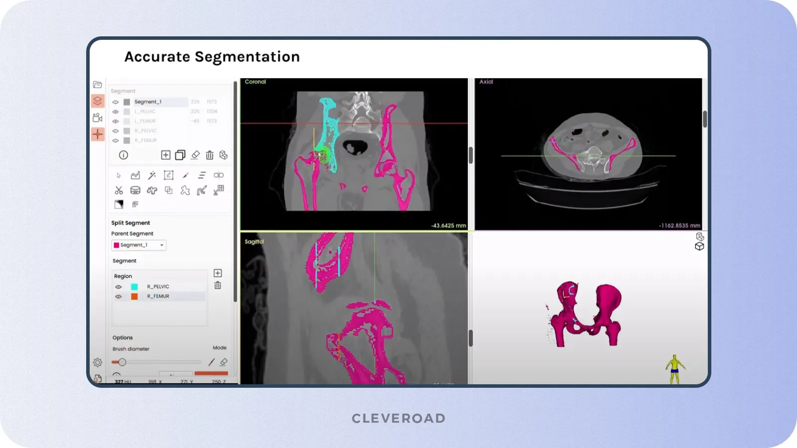 Image segmentation feature example