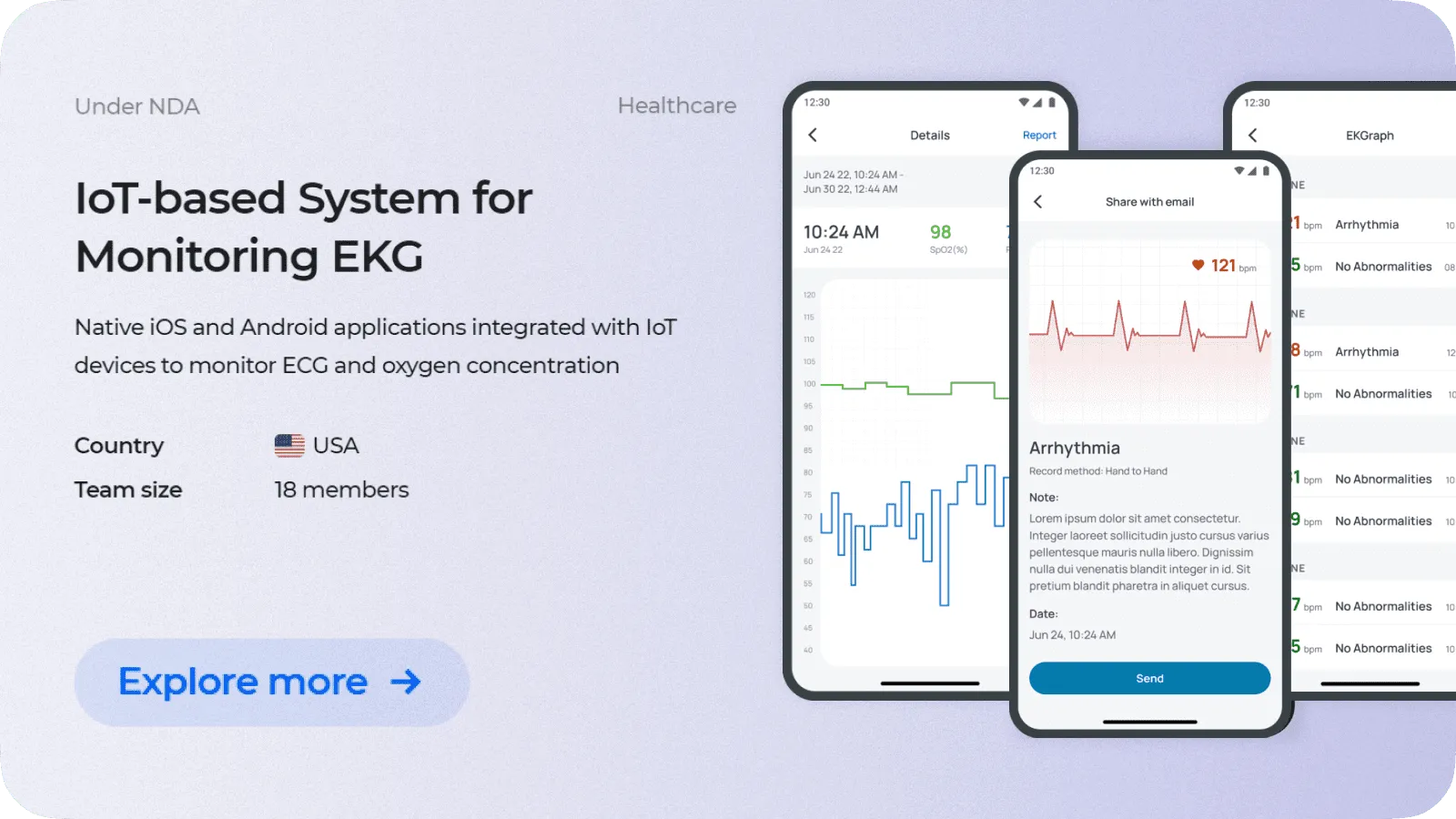 IoT-based System for Monitoring EKG and Blood Oxygen Level