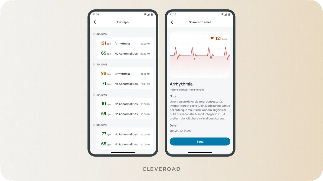 IoT system for measuring ECG developed by Cleveroad