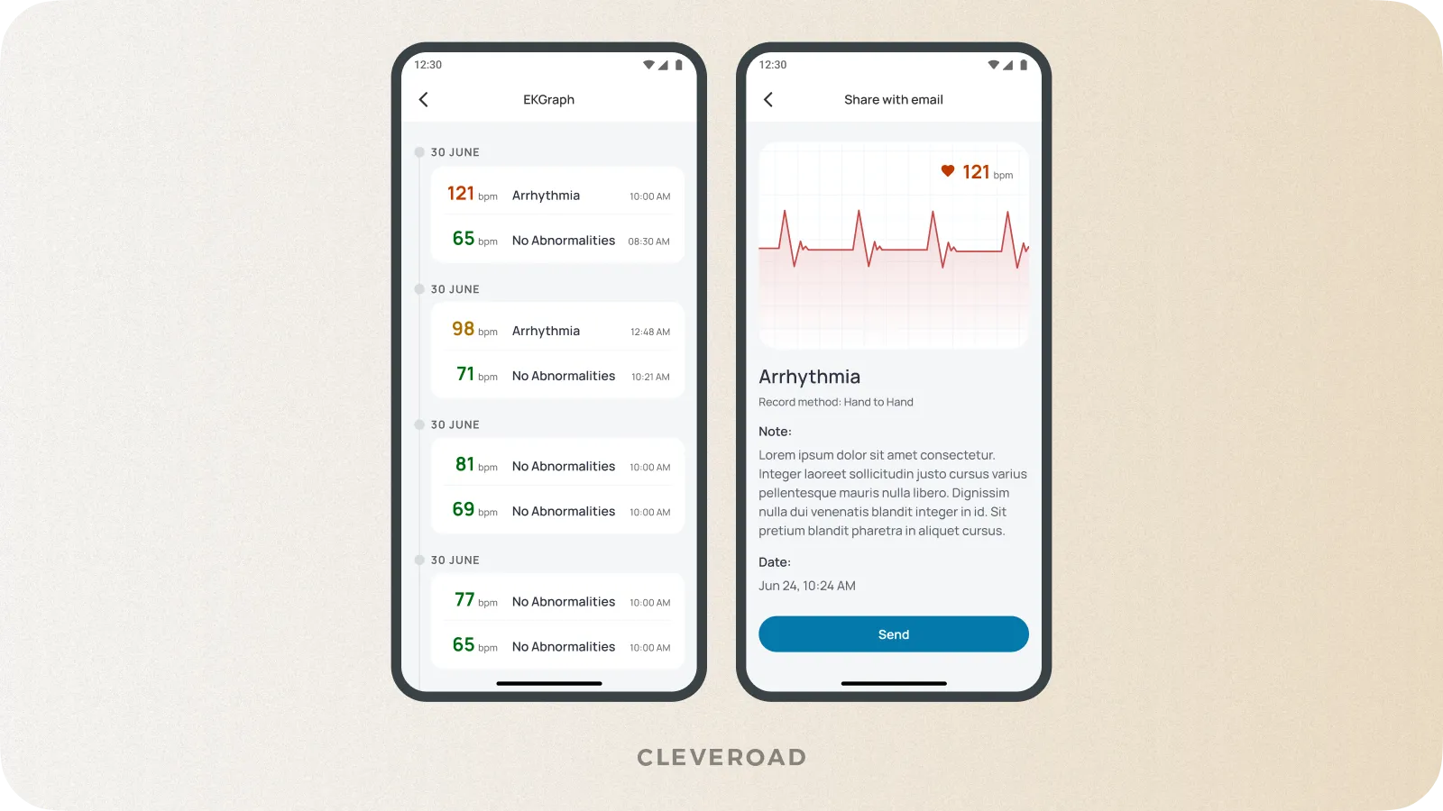 IoT system for measuring ECG developed by Cleveroad