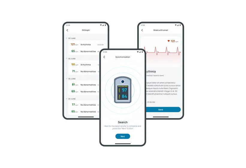 IoT-based System for Monitoring EKG